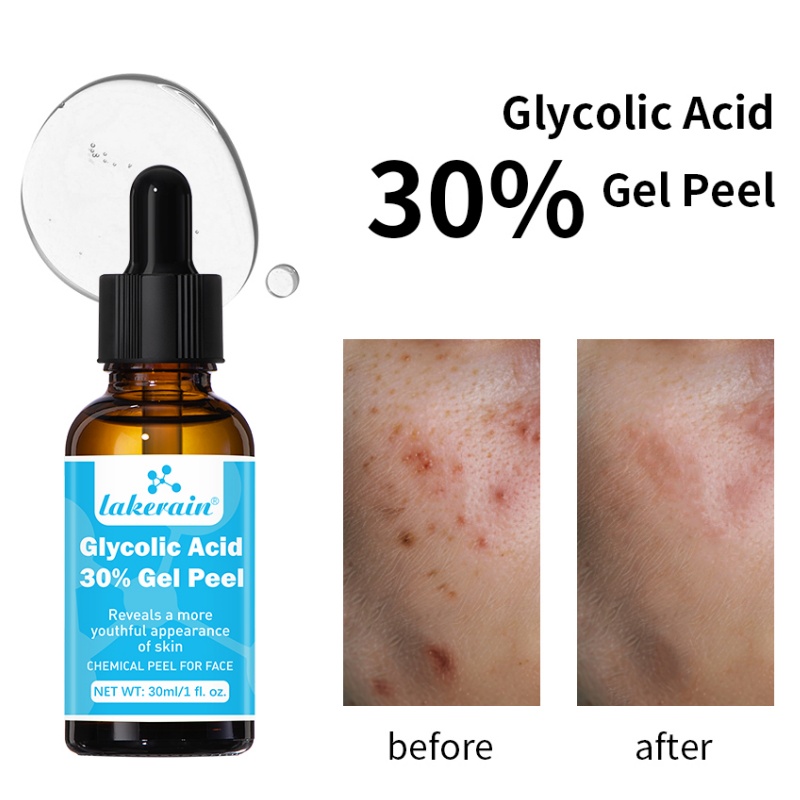 Lactic Acid Toner - Gel Anti-âge pour le visage, acide