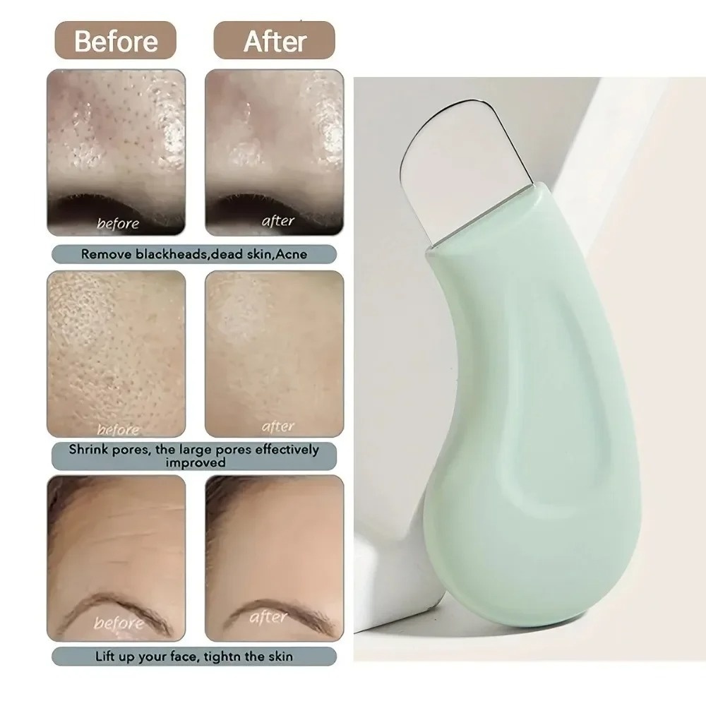 Outil de nettoyage en profonde - Skincare Routine avis et prix
