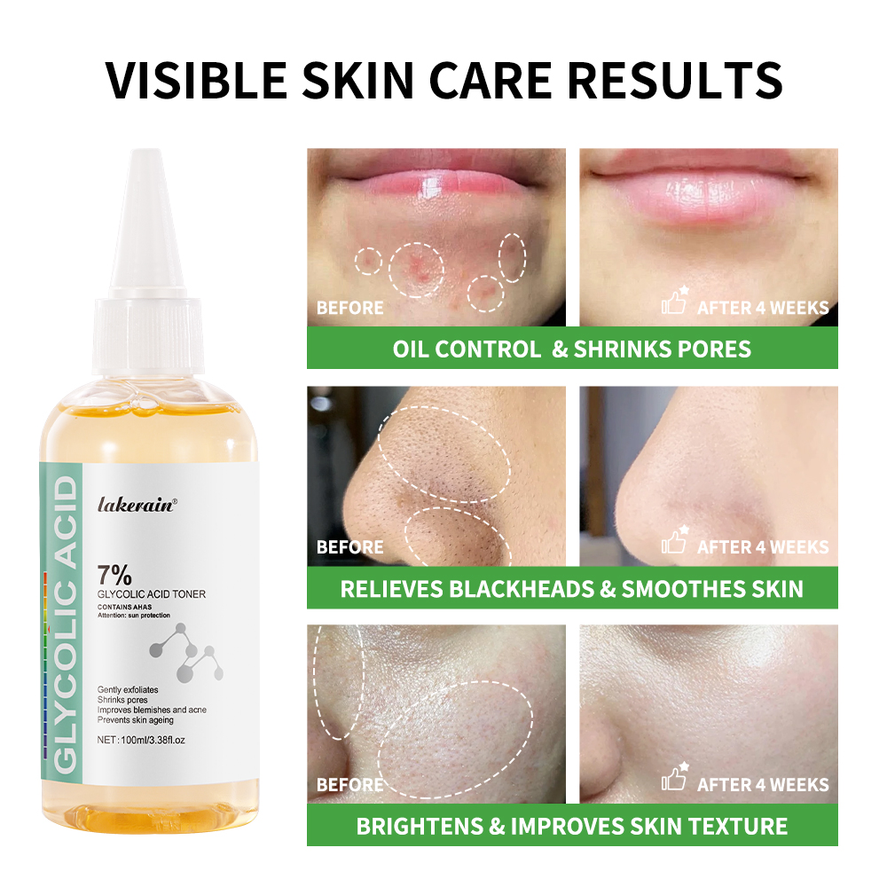 Solution tonifiante à l'acide  - Lactic Acid Toner avis et prix